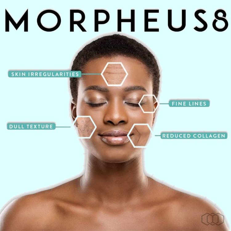 morpheus8 imagery